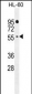 AP11217c-FBXW11-Antibody-Center