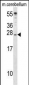 IGF2 Antibody (Center R54)