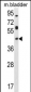 HOXD13 Antibody (Center)