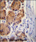 CTNB1 Antibody (C-term)