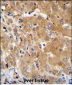 GGH Antibody (N-term)