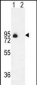 ENG Antibody (Center)