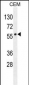 LIPC Antibody (N-term)