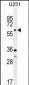 TNFRSF1A Antibody (N-term)