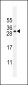 SPACA5B Antibody (N-term)