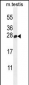 PLD6 Antibody (Center)