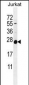 POLR2J Antibody (C-Term)