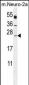 POLR2J Antibody (C-Term)