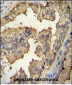 PRMT4 Antibody(Center)