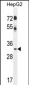 CCNG1 Antibody (N-term)