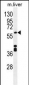 CYP1A2 Antibody (Center)