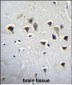 GRIN2A Antibody (Center)