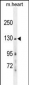 GRIN2A Antibody (Center)