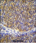 PSMB11 Antibody (C-term)