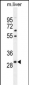 PHOX2B Antibody (Center)