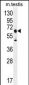 DNAAF3 Antibody (Center)