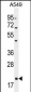 EDN1 Antibody (Center)