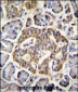 GRIN2A Antibody (C-term)