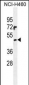PRAMEF6 Antibody (C-term)