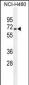 ZSCAN5B Antibody (C-term)