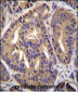 GTF2H2C Antibody (C-term)