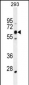 KRBA2 Antibody (Center)