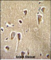 CRFR2 Antibody (D35)