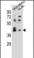 SOX3 Antibody (Center)