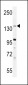 JHDM2b Antibody (C-term)