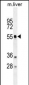 ATG4D  Antibody (N-term)