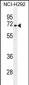 NUMB Antibody (N-term)