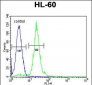 CPT1C Antibody (C-term)