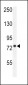 CPT1C Antibody (C-term)