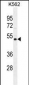 NUDT19 Antibody (Center)