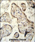 RSBN1 Antibody (N-term)