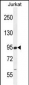 RSBN1 Antibody (N-term)