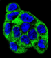 ATP6V1B1 Antibody (Center)