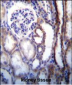 ATP6V1B1 Antibody (Center)