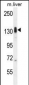 LMTK3 Antibody (N-term)