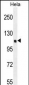 KIAA0999 Antibody (C-term)