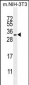 RRAS Antibody (Center)