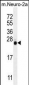 LIN28 Antibody