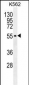 MITF Antibody (N-term)