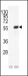 OPN-a/b Antibody (N-term)