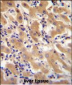 F11 Antibody (Center)