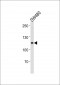 MSH2 Antibody (Center)