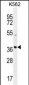 SFRP4 Antibody (C-term)