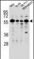 FOXC2 Antibody (Center P198)