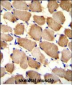 ARL17P1 Antibody (Center)