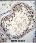 OVOS Antibody (N-term)